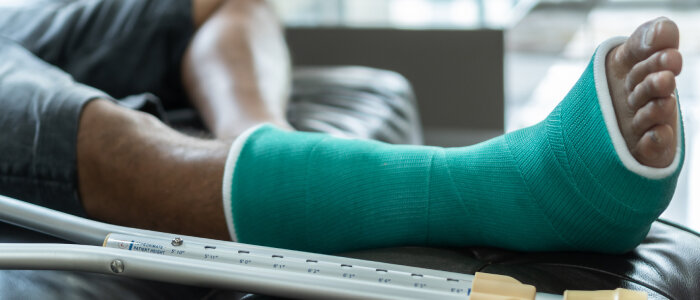 A person with a broken leg in a cast