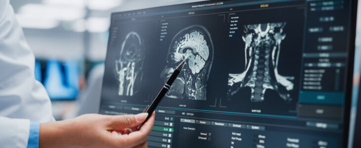 Medical Hospital: Neurologist and Neurosurgeon Talk, Use Computer, Analyse Patient MRI Scan, Diagnose Brain. Brain Surgery Health Clinic Lab: Two Professional Physicians Look at CT Scan. Close-up