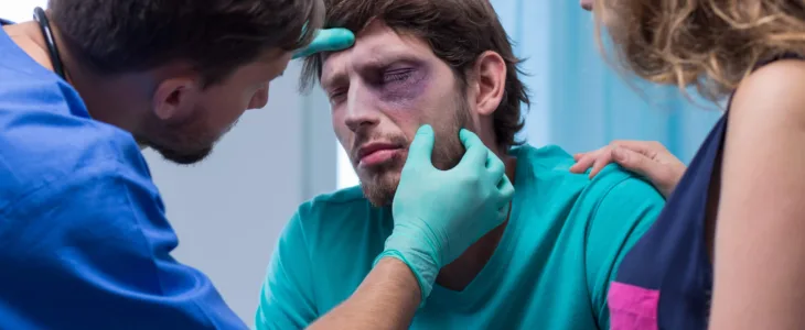 Beaten man with black eye in emergency room